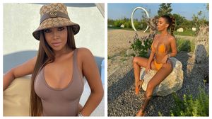 Andra Voloș a dezvăluit cum arăta înainte de operațiile estetice