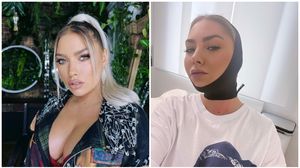 jo, operatii estetice, jo joana, gusa