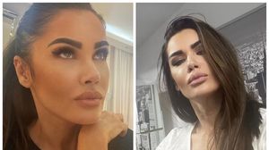 Oana Zăvoranu, adevărul despre operațiile estetice