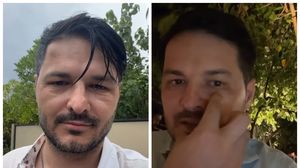 Liviu Vârciu, umflat la față