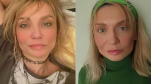 cristina cioran, interventii, proceduri, fata, gat