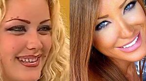 Bianca, inainte si dupa zece ani