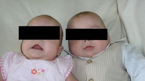 Doi gemeni născuți în timpul pandemiei au fost numiți după virus