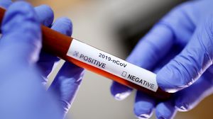 Încă șase români au murit din cauza coronavirusului. Bilanțul a ajuns la 723