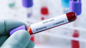 Alertă maximă! Zeci de credincioși au fost infectați cu COVID-19 după ce au luat parte la o slujbă religioasă