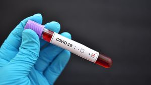 Alte 151 de cazuri de îmbolnăvire cu coronavirus