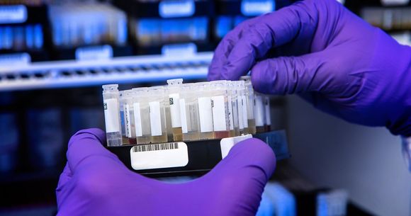 bilant coronavirus 15 noiembrie 2022