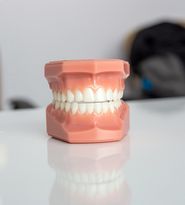 Ce este parodontoza și cum poate fi prevenită