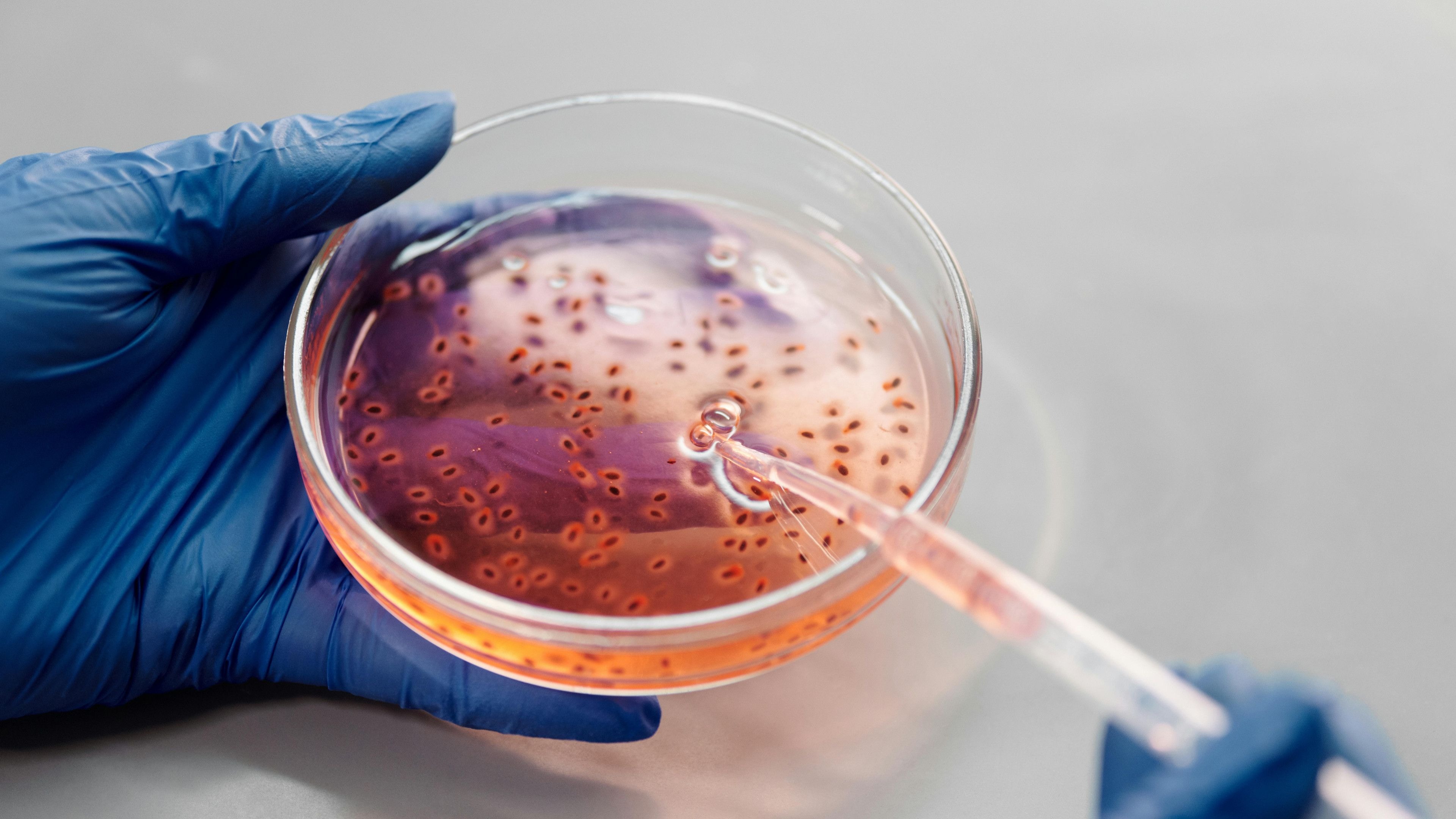 La Spitalul „Sfânta Maria” din Iași a fost descoperită bacteria Serratia! Aceasta a fost găsită și la Spitalul din Târgu Mureș, unde copiii au scăpat cu viață