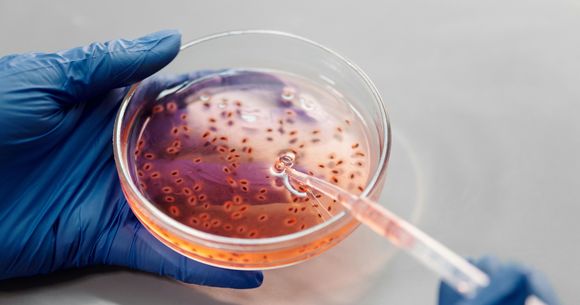 bacterie microscop