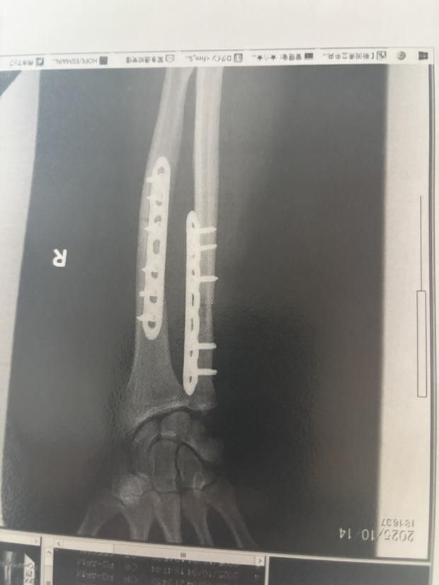 radiografie