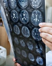 (P) Recuperare AVC: importanța intervenției timpurii și a sprijinului familial