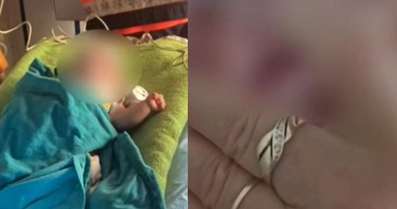 Asistentă cu inele la spital