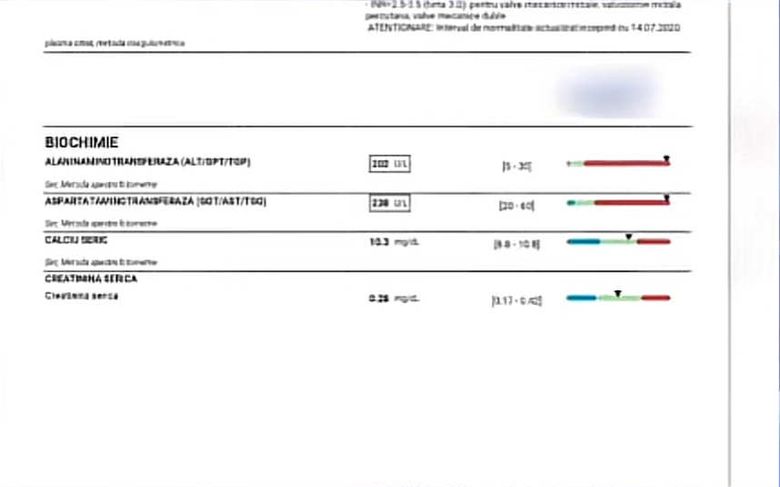 A apărut buletinul de analize al Sarei, fetița de 2 ani care și-a pierdut viața în cabinetul stomatologic. Ce valori i-au ieșit cu mult peste limita normală | FOTO