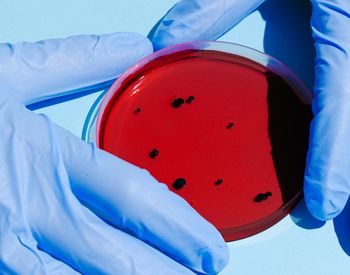 Cum se transmite lepra și cum &icirc;ți dai seama că ai intrat &icirc;n contact cu boala. Este alertă epidemiologică după confirmarea unui caz la Cluj-Napoca