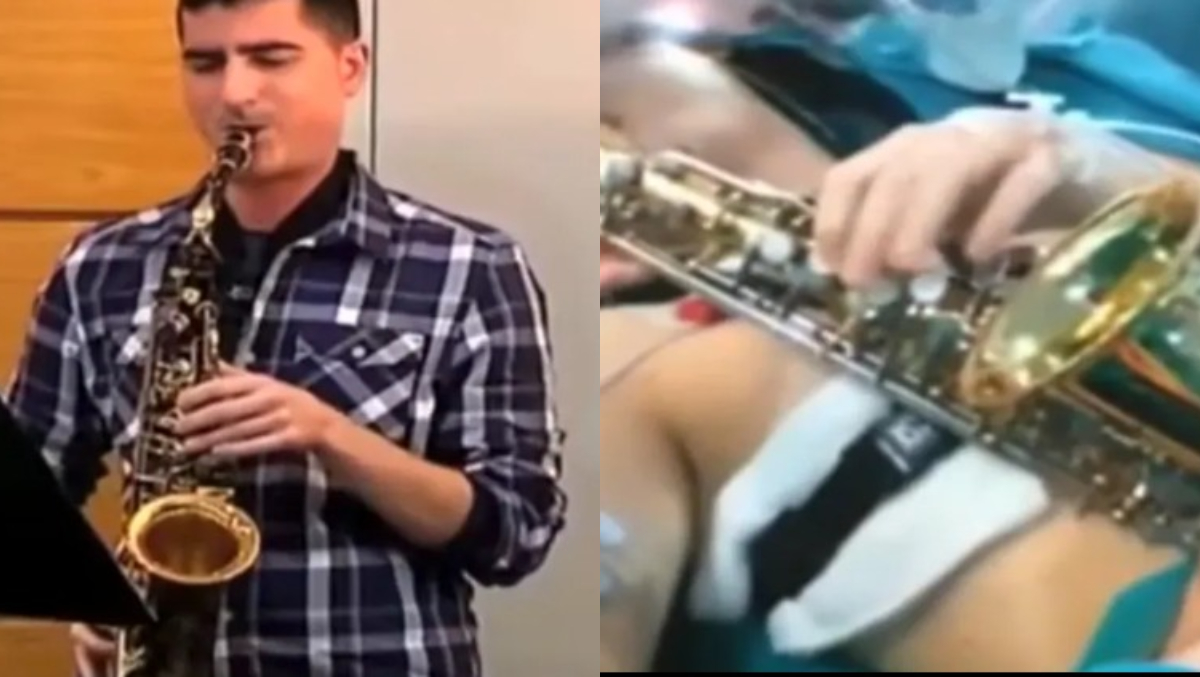 Carlos Aguilera, artistul care a cântat 12 ore la saxofon în timp ce era operat pe creier, s-a stins din viață la 38 de ani