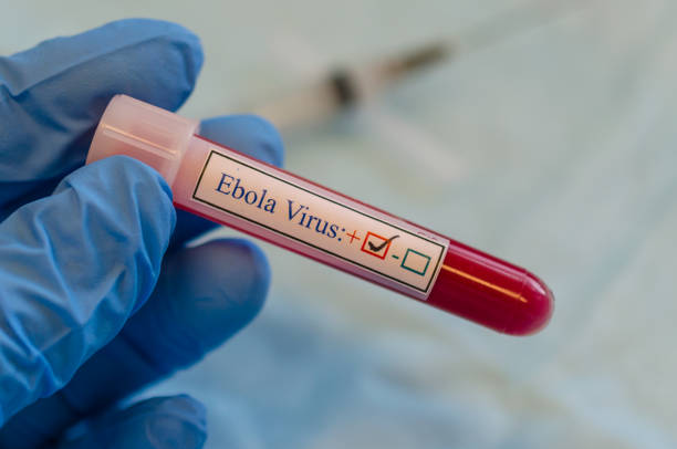 Cel puțin 131 de decese în urma epidemiei de Ebola. SUA introduce o serie de măsuri pentru a preveni pătrunderea bolii în țară