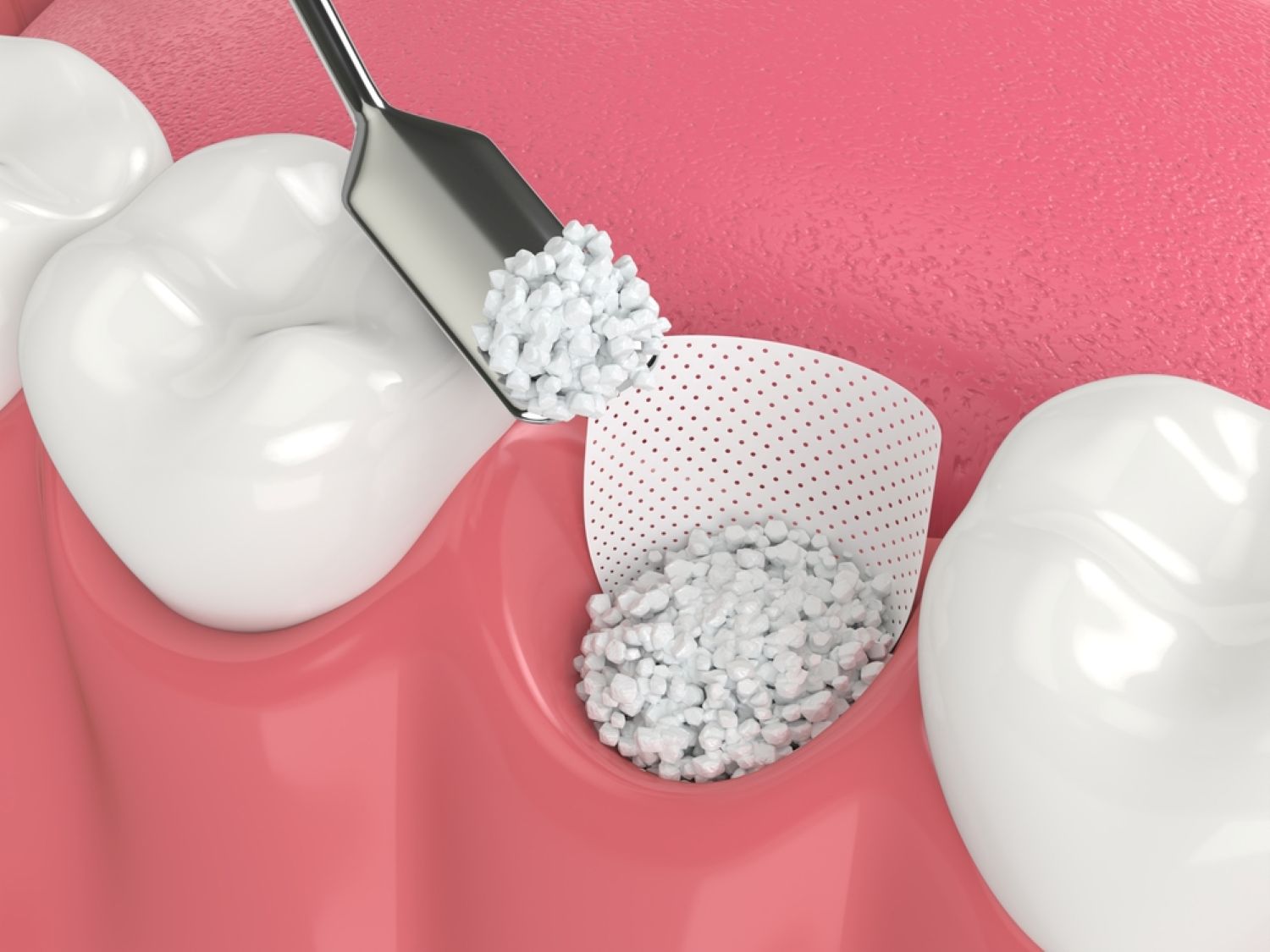 (P) Top 7 biomateriale dentare recomandate pentru cabinete și laboratoare