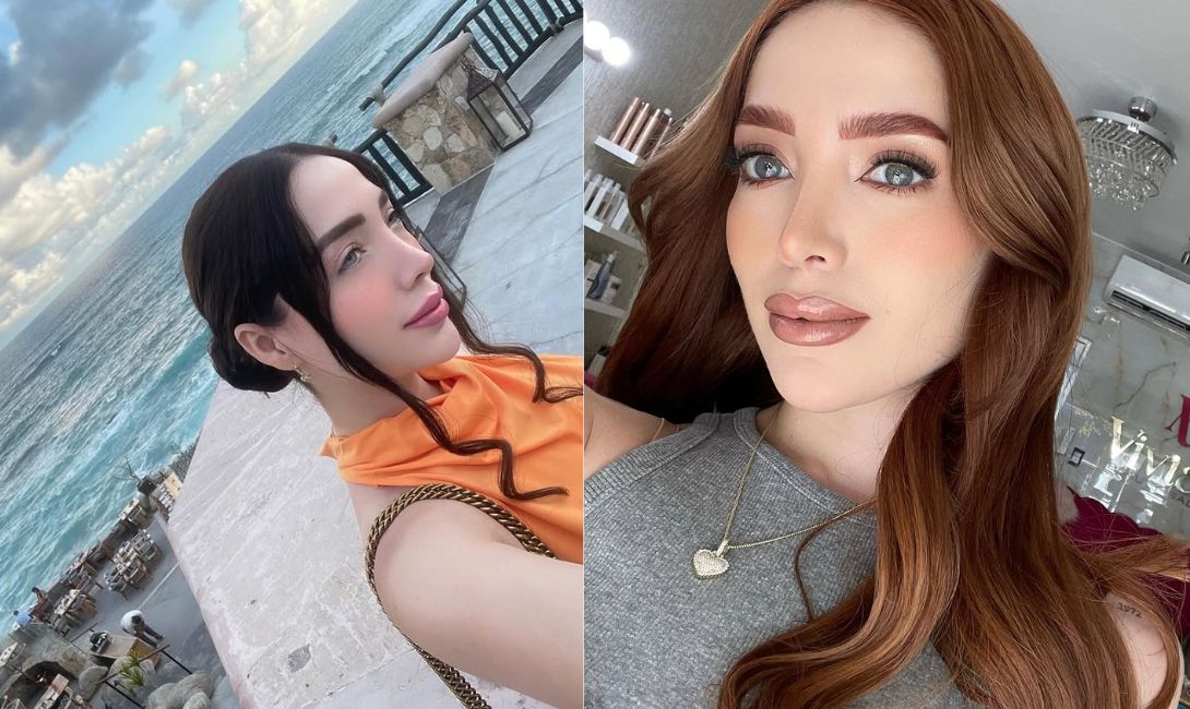 O cunoscută influenceriță s-a stins din viață la doar 30 de ani, în timpul unei intervenții estetice