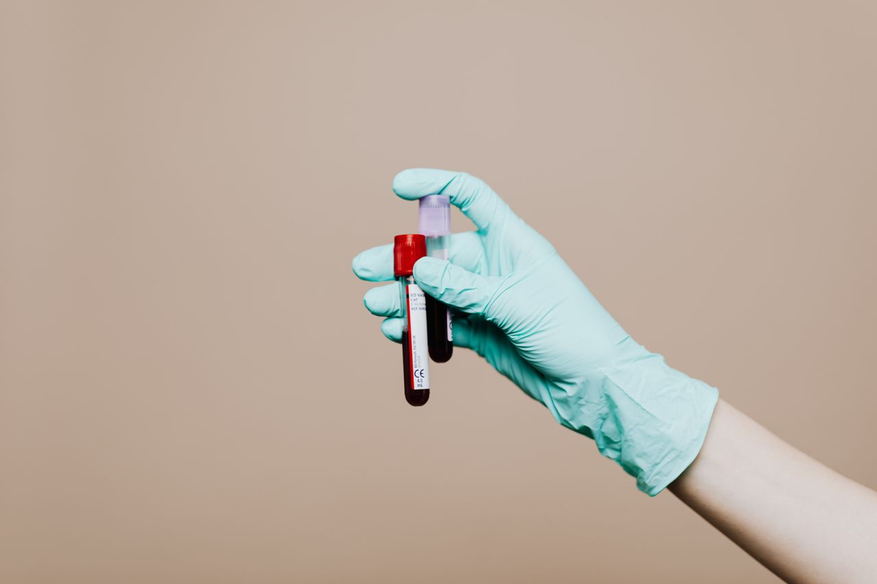 (P) Ficat și metabolism: ce măsoară analizele uzuale de biochimie