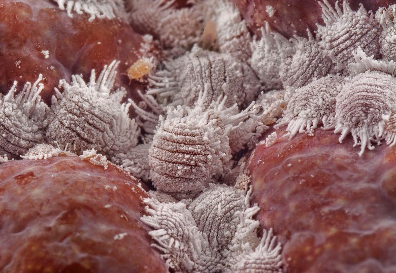 Scabia se transmite prin contact direct cu pielea