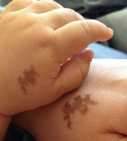 Secretele semnelor din nastere: Locul unde au aparut pe corp spune multe despre tine!