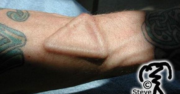 Modificari EXTREME ale corpului! Tu ti-ai face asa ceva? FOTO