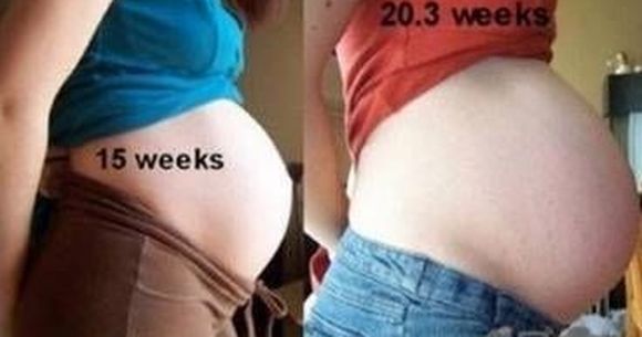 Fotografiile care te fac sa nu-ti mai doresti sa devii mama. Vezi GALERIE FOTO si vei intelege de ce!