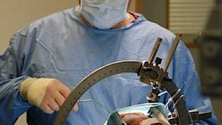 operație pe creier timișoara