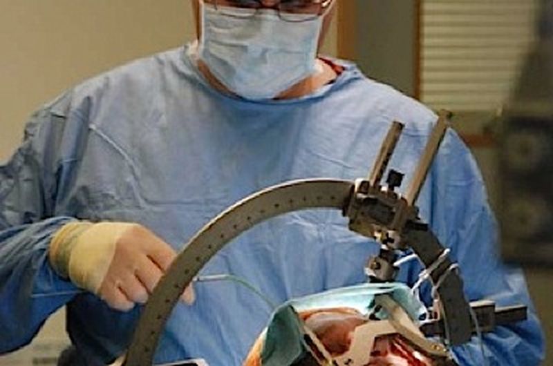 operație pe creier timișoara