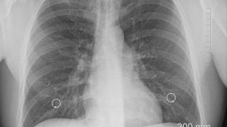 planeta lovită de o nouă boală