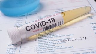 Cât costă un certificat fals pentru test negativ de COVID-19, la intrarea în Grecia