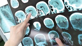 Bilanț coronavirus, 17 iulie: un nou RECORD negativ. Explozie de cazuri la Terapie Intensivă