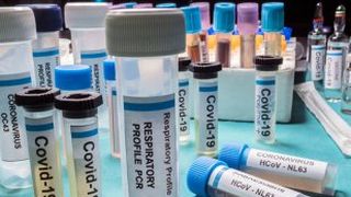 MAE: Alţi patru turişti români din Grecia, confirmaţi cu coronavirus