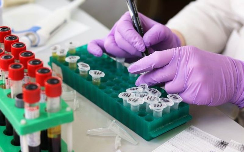 Tratament pentru coronavirus