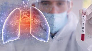 Jumătate dintre pacienţii cu covid-19 asistaţi respirator au murit în Germania