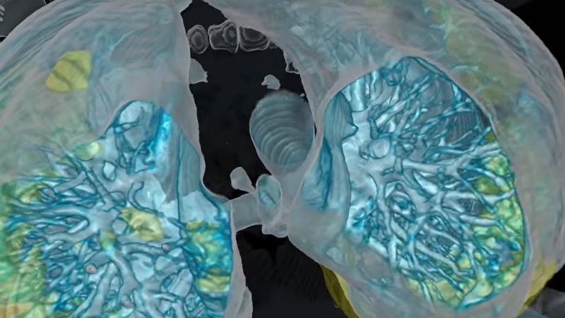 oms populație predispusă