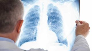 OMS: Noul coronavirus încă circulă şi majoritatea populaţiei rămâne predispusă la infectare