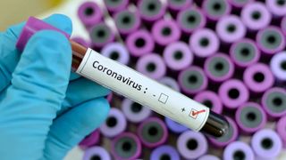 angajați coronavirus