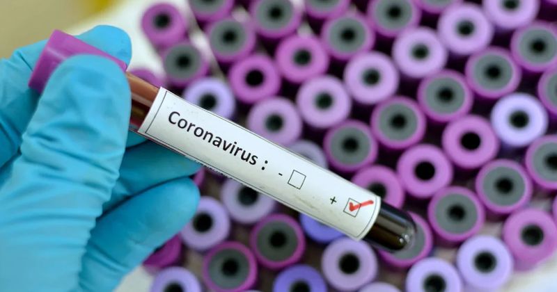 angajați coronavirus