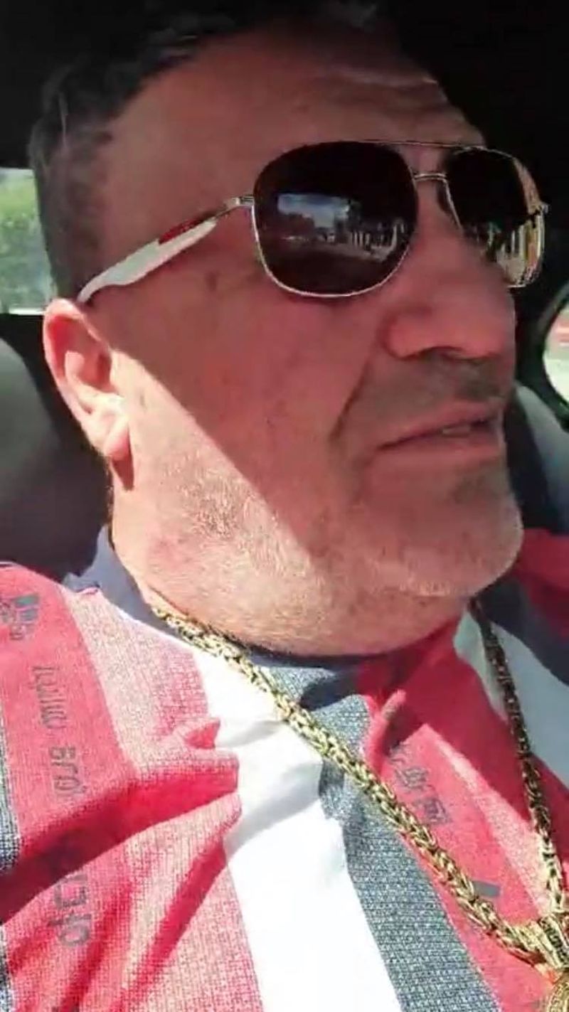 nelson și-a pus dinți