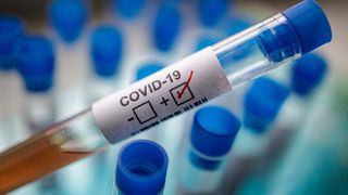 coronavirus 16 august 2020