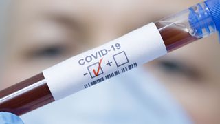 &Icirc;ncă două cazuri de coronavirus, confirmate la TVR