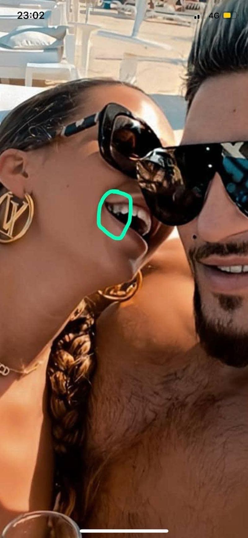 andra volos probleme cu dantura