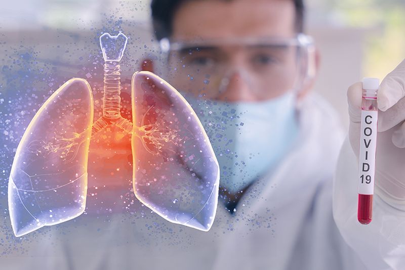 coronavirus decese în lume