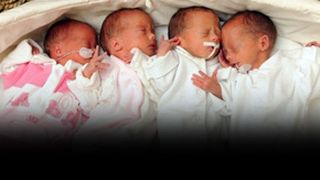 VIDEO - Gemenii care au nevoie de tratament. Cel mai scump tratament din lume