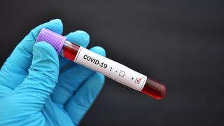 Coronavirus