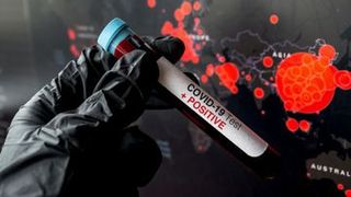 Focar de COVID-19 la Secţia de radiologie a Spitalul Municipal Ploieşti