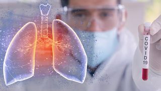 Creştere record, la nivel global, a cazurilor de infectare cu coronavirus