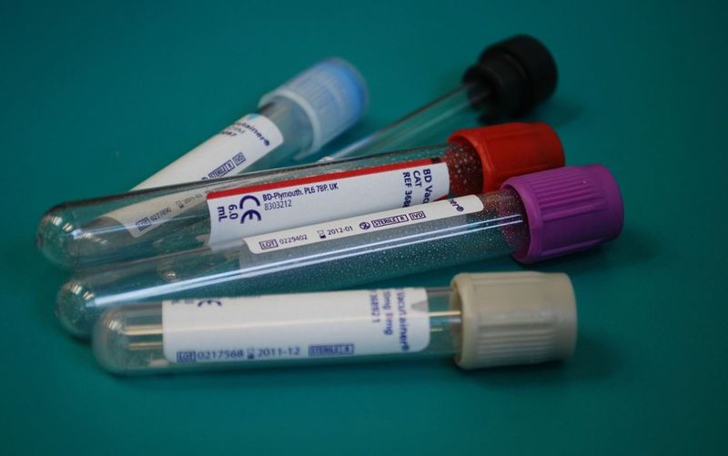 nu mai sunt locuri la terapie intensivă